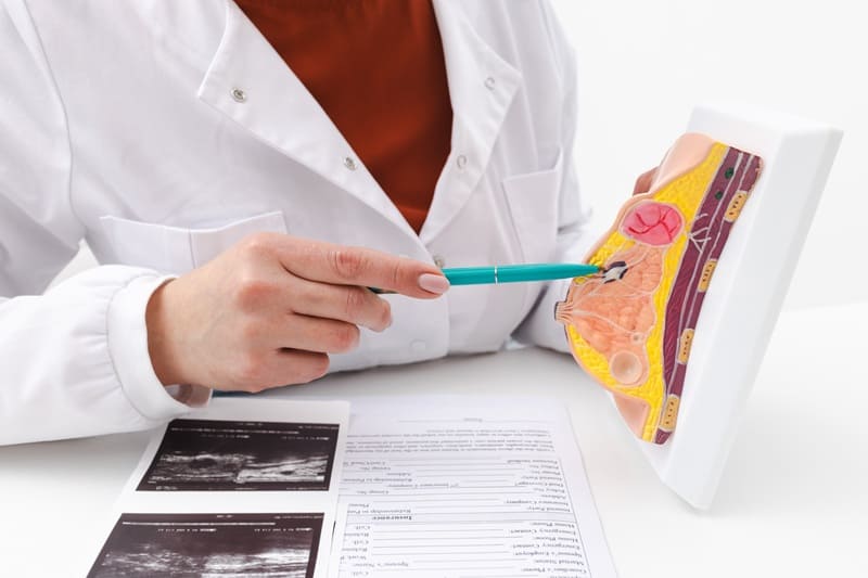 Colocación de arpón por mamografía en Jalisco, México